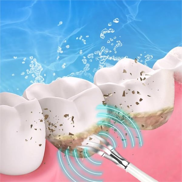 Electric Ultrasonic tooth cleaner
