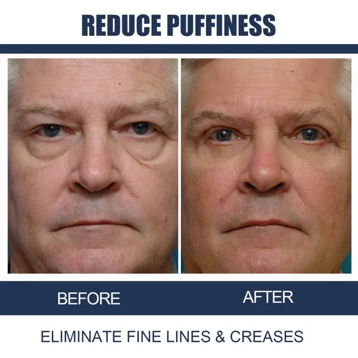 Awaken Peptide Lifting Eye Gel YT