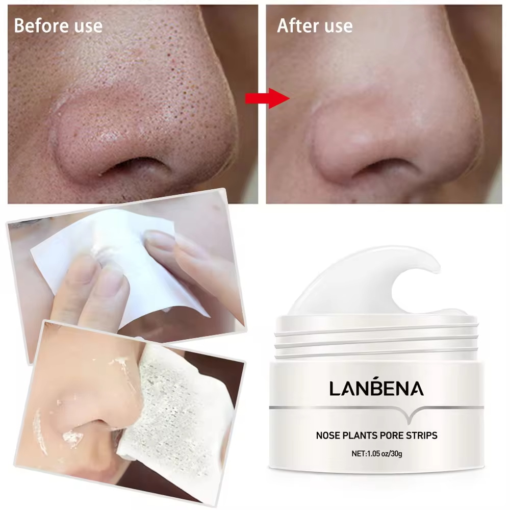 LANBENA Blackhead Remover