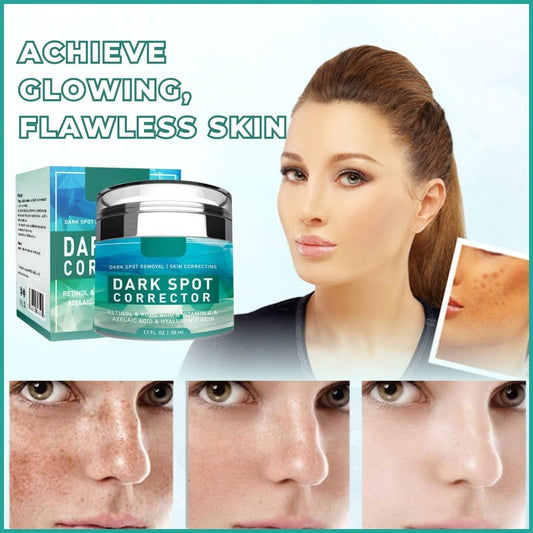 Yujia™ Melasma and Dark Spot Corrector Cream YT