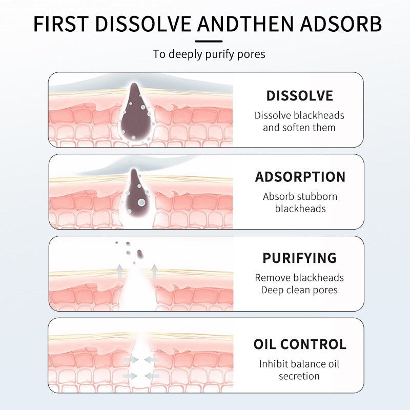 LANBENA Blackhead Remover