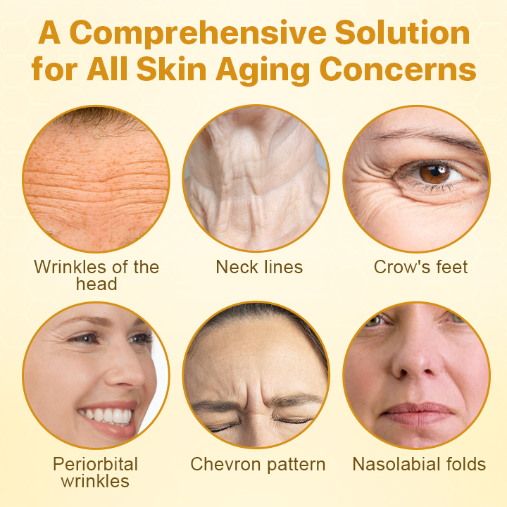 Erase Wrinkles Naturally – for Men & Women