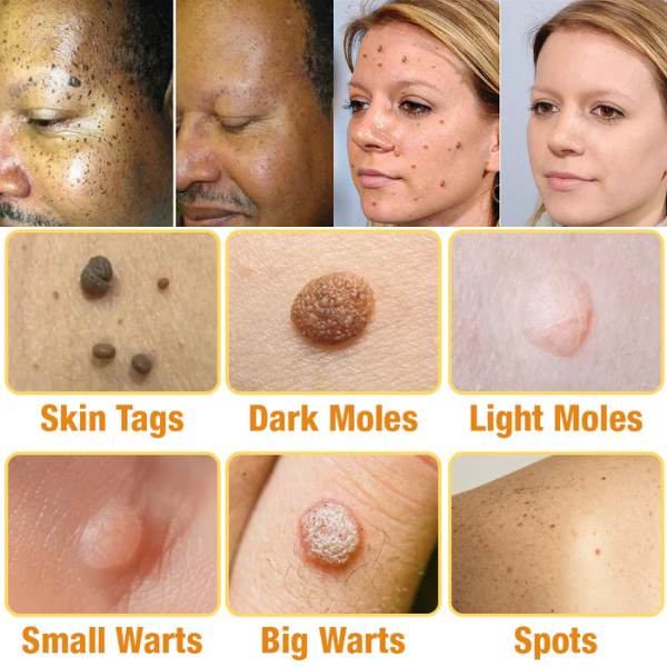 TagRecede Bee Venom Treatment Spray