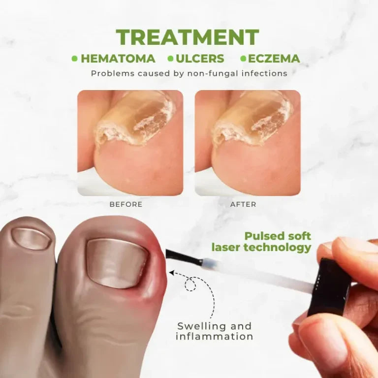 FungiVanish Bee Venom Nail Treatment Oil