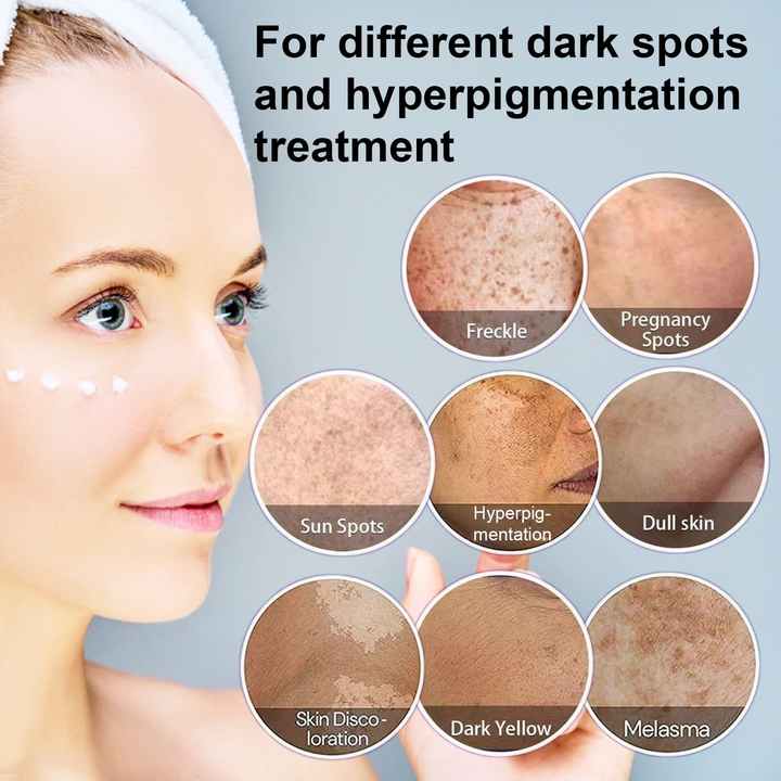 Yujia™ Melasma and Dark Spot Corrector Cream YT